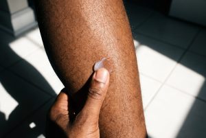 A thumb presses a dab of clear ointment onto a man's shin in hard morning sun